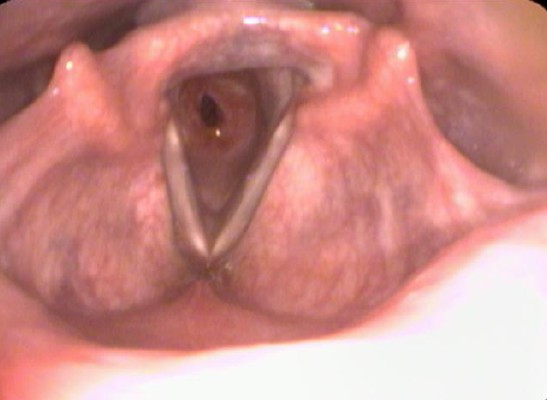 airway disorder specialist Bengaluru